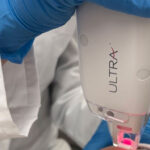 Clearlift Laser for Skin Rejuvenation: The Ultimate Non-Invasive Solution